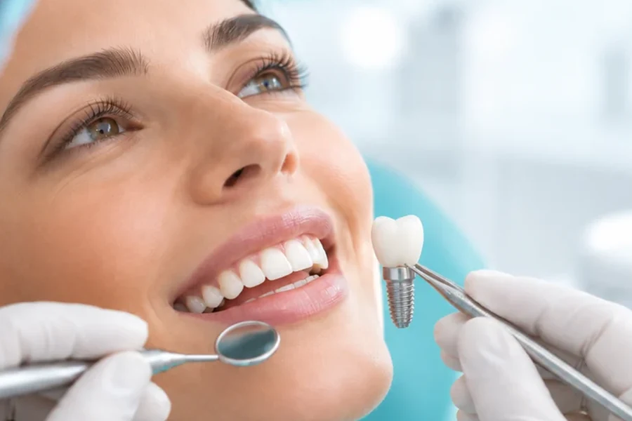 Implantes dentales